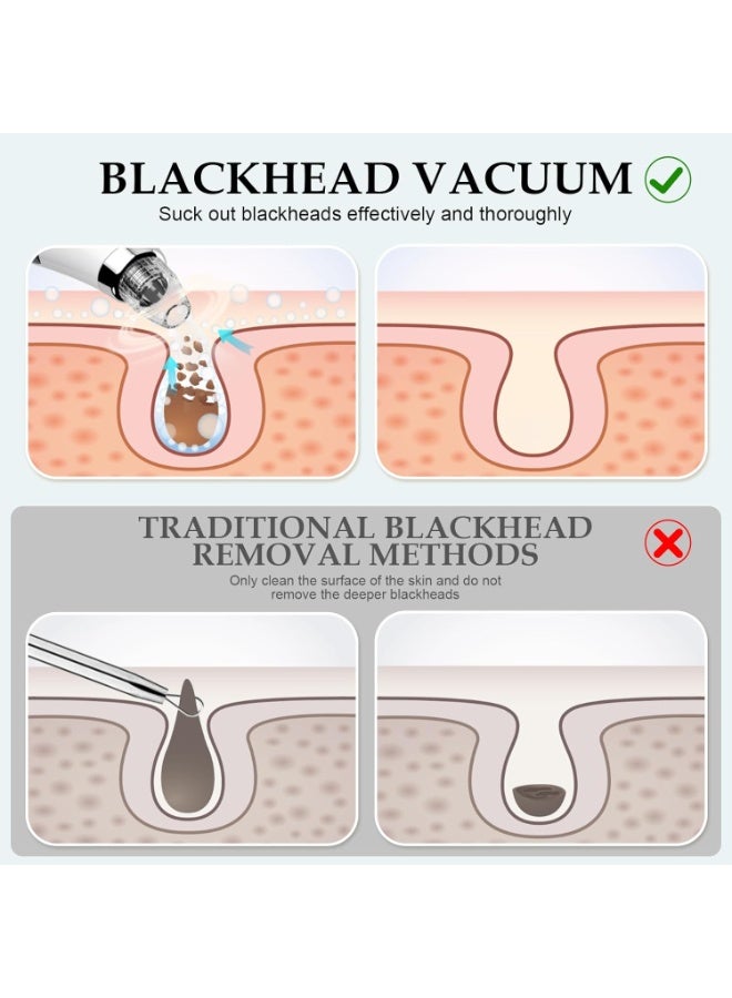 general Facial Pore Blackhead Remover Vacuum - Fore Cleaner and Blackhead Extractor with 3 Adjustable Suction Levels - 5 Probes - Pore Vacuum Kit for Women&Men (White) - Image 5